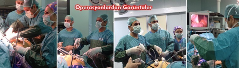 Tüp Mide Ameliyatı Esnasından Görüntüler