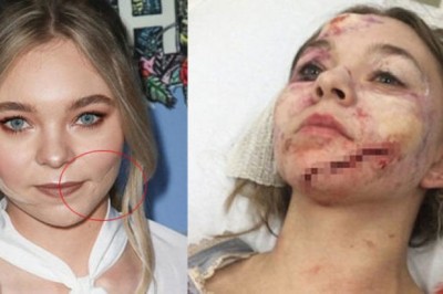  Taylor Hickson' ın sette yaşadığı korkunç kaza!