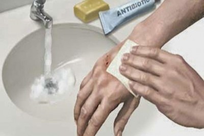 Kanamayı Durdurmak İçin Neler Yapılmalı? Kanama Nasıl Durdurulur?