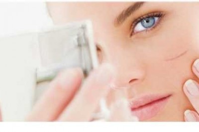 Yara İzlerine Ne İyi Gelir ?