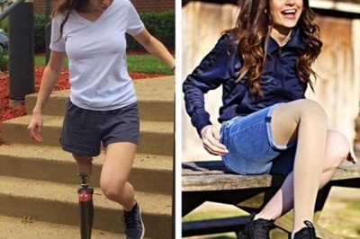 11 Yaşında Bacağı Kesilmişti Ama Dünya Markalarını Peşinde Koşturuyor