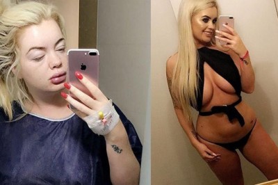 Loto Milyonerinin Yeni Hali Görenleri Şaşırtıyor