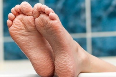 El ve Ayaklarımız  Suya Maruz Kalınca Neden Buruşur?