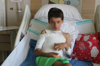 Sosyal medyadan görüp üzerine kolonya döktüğü ikizini yaktı