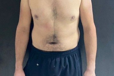 Altındağ’daki bıçaklı saldırının zanlıları tutuklanarak cezaevine gönderildi